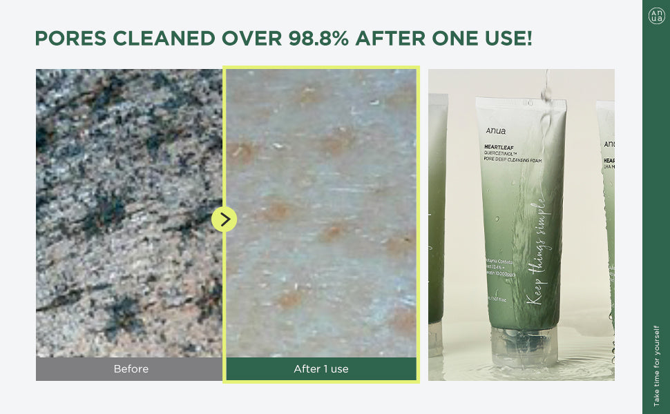 ANUA Heartleaf - Espuma limpiadora profunda de poros de