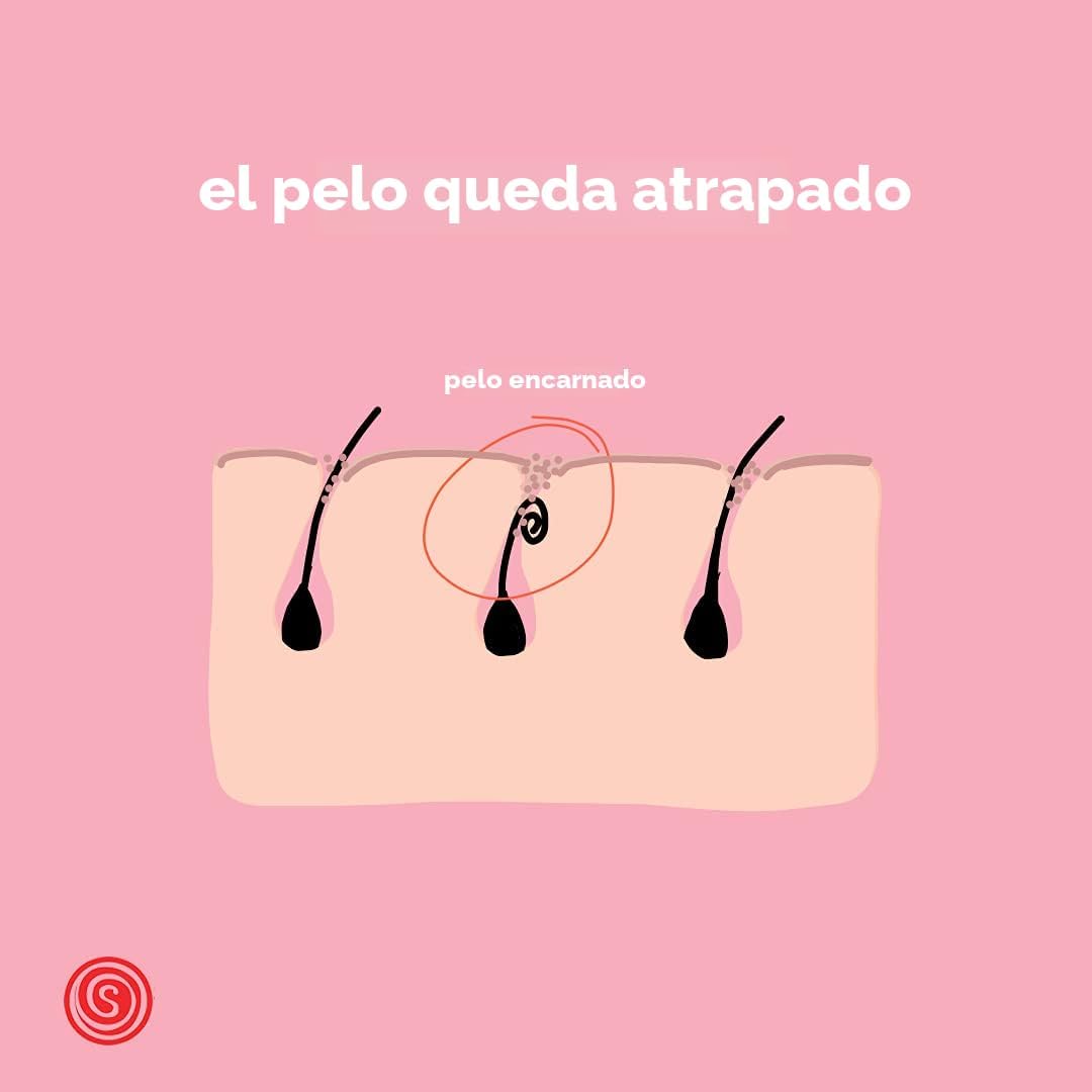 Cera de azúcar dura para las áreas más difíciles: cavado, depilació...