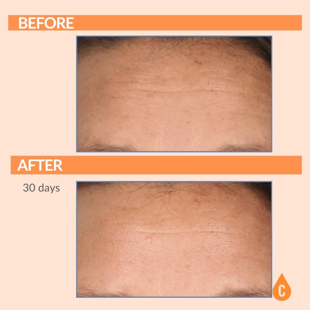 Serious Skincare - Serious-C3 Plasma Vitamin C Restore - Crema de n...