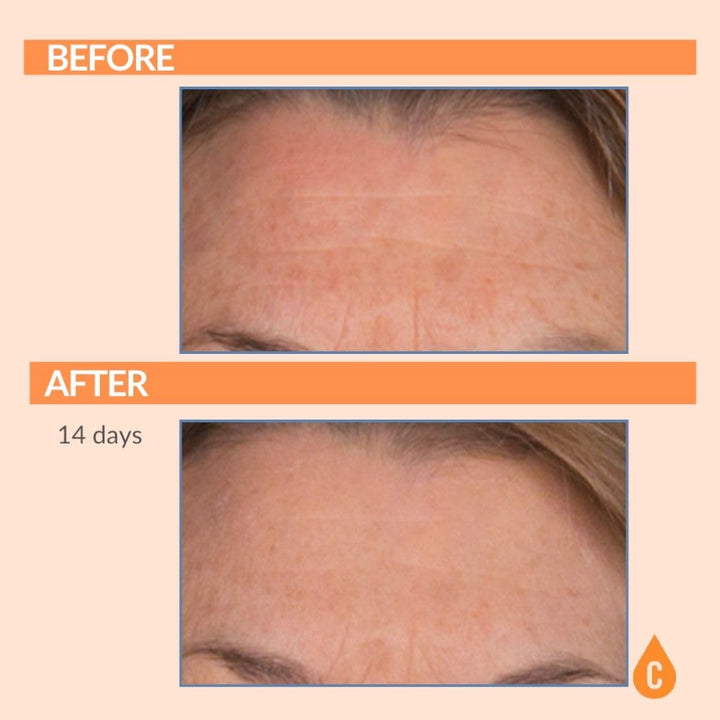 Serious Skincare - Serious-C3 Plasma Vitamin C Restore - Crema de n...