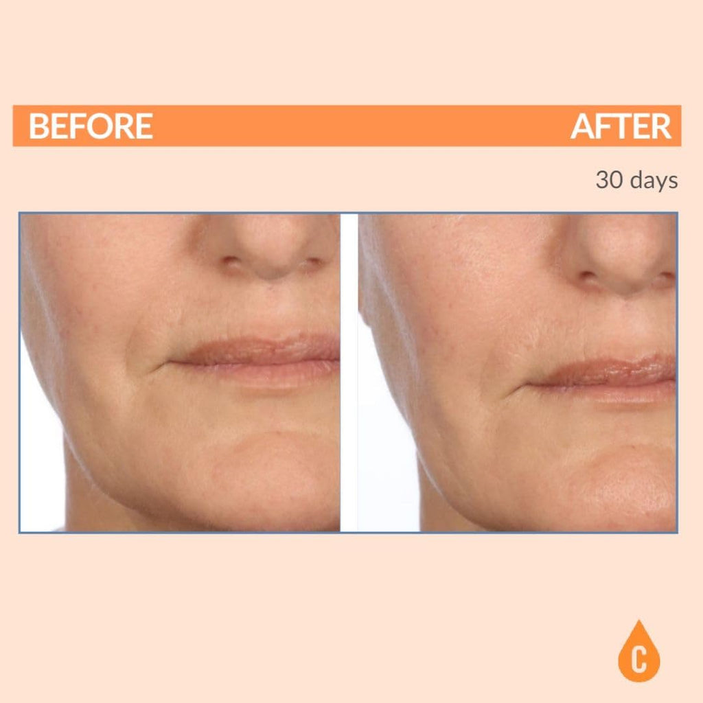 Serious Skincare - Serious-C3 Plasma Vitamin C Restore