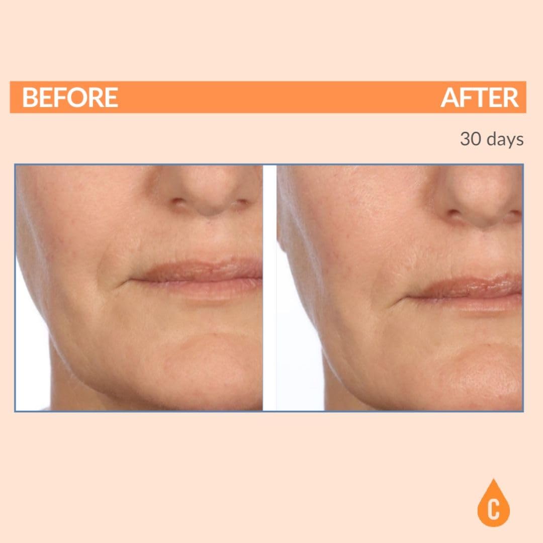 Serious Skincare - Serious-C3 Plasma Vitamin C Restore - Crema de n...