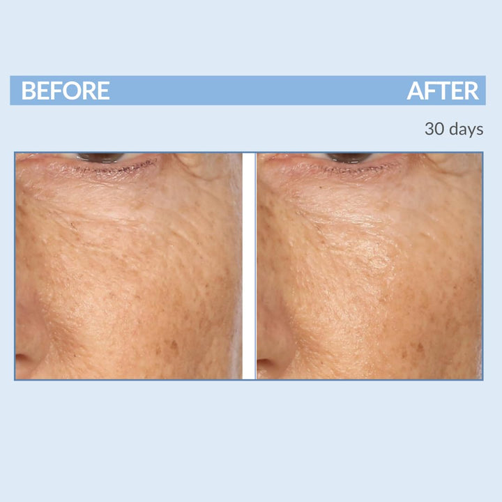 Serious Skincare Un trío Defiance para cara y cuello \u2013 Anti-en...