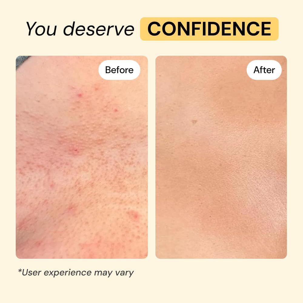MyMagicHealer Universal Flare Care | Pomada Extractora para HS, for...
