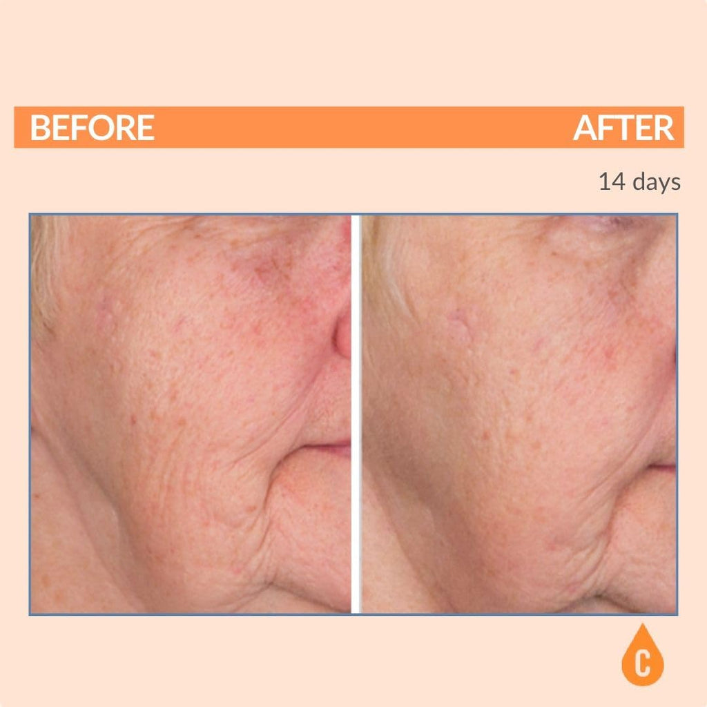 Serious Skincare - Serious-C3 Plasma Vitamin C Restore