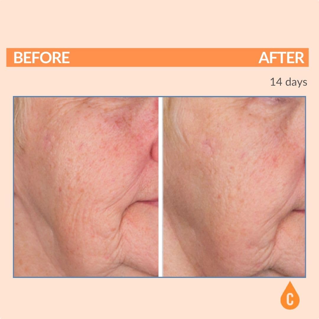Serious Skincare - Serious-C3 Plasma Vitamin C Restore - Crema de n...