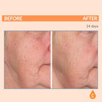 Serious Skincare - Serious-C3 Plasma Vitamin C Restore