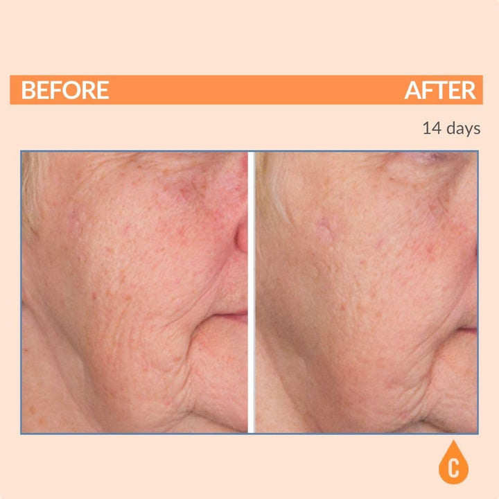 Serious Skincare - Serious-C3 Plasma Vitamin C Restore - Crema de n...
