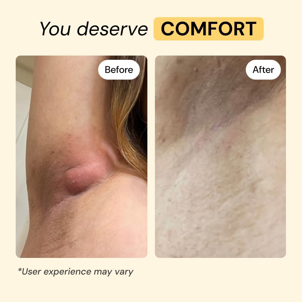 MyMagicHealer Universal Flare Care | Pomada extractora para HS, for...