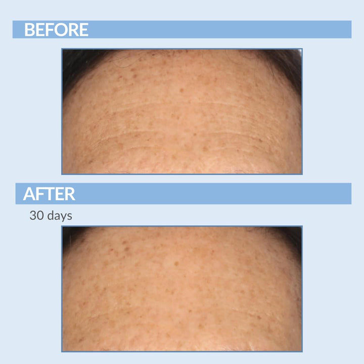 Serious Skincare Un trío Defiance para cara y cuello \u2013 Anti-en...