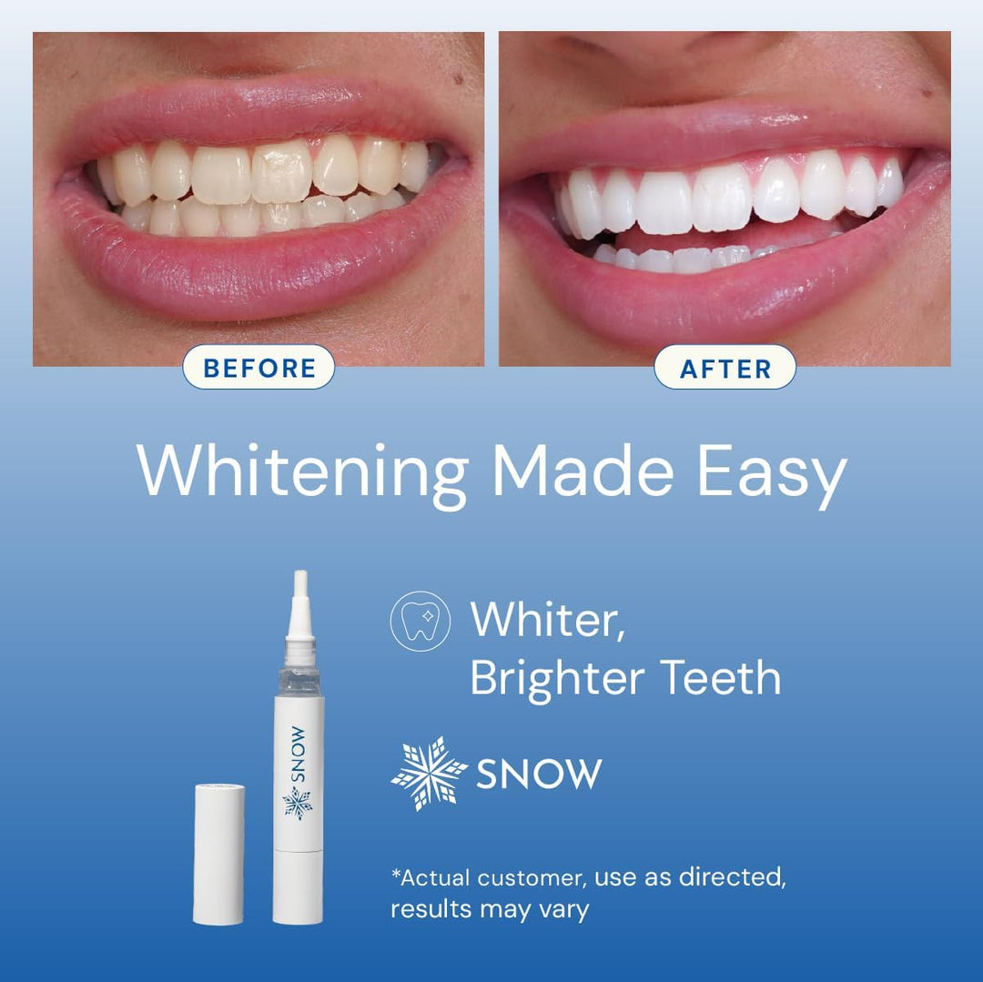 SNOW Overnight - Pluma blanqueadora de dientes con hidroxiapatita -...