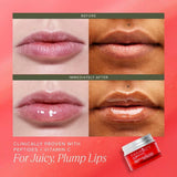 Farmacy Apple A Day - Kit de bálsamo labial \u2013 Tratamiento de p...