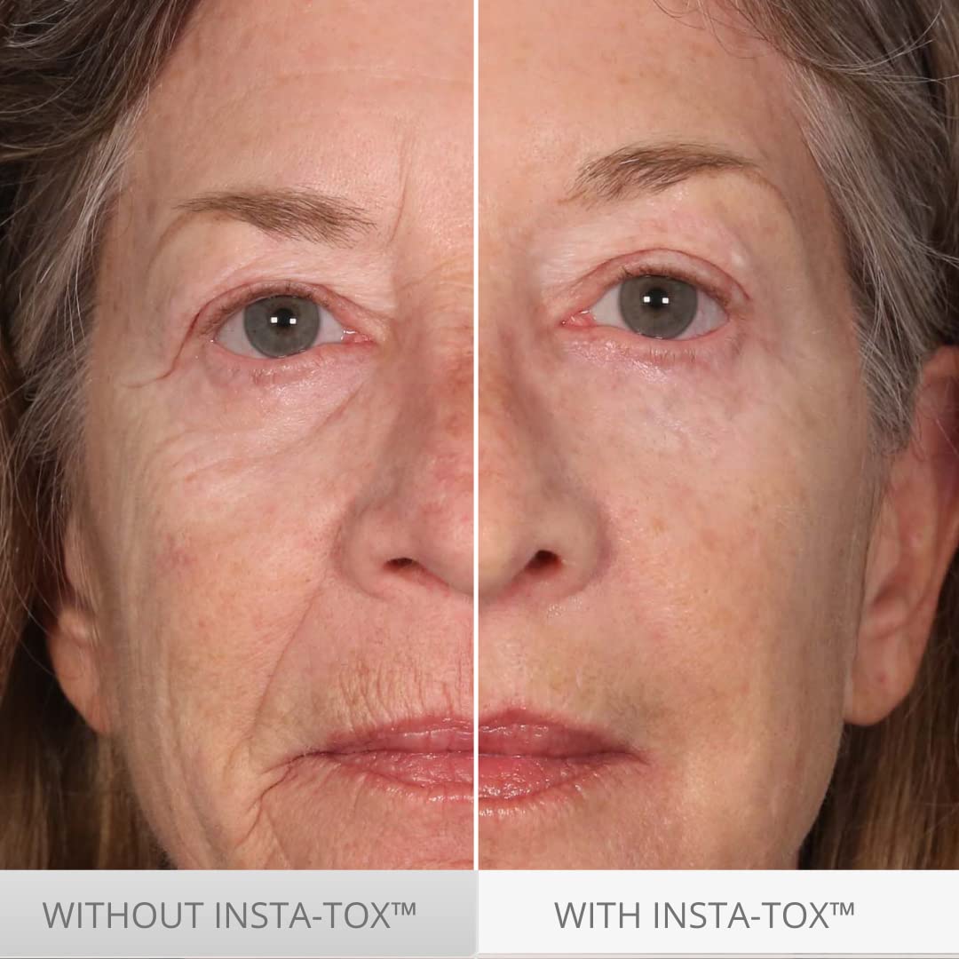 Serious Skincare INSTA-TOX - Suero instantáneo para la piel, suaviz...