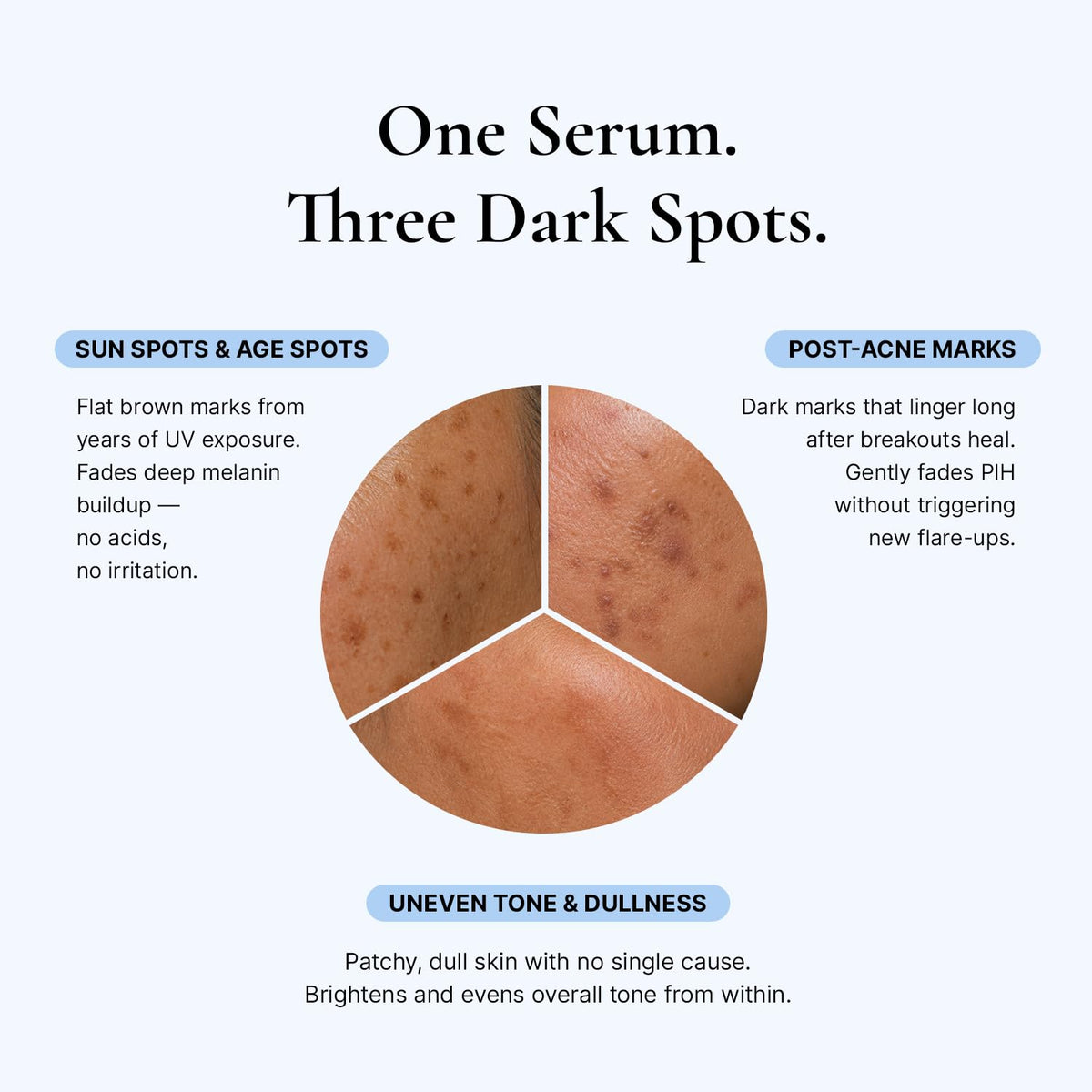 EnaSkin Crema correctora de manchas oscuras para el cuerpo y elimin...