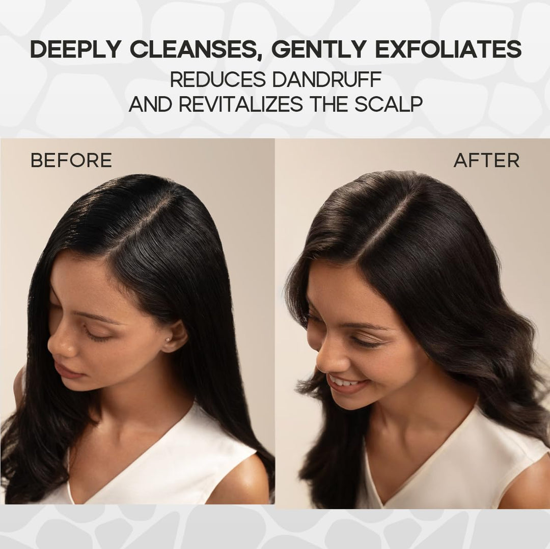 HALOVIDA Exfoliante para cuero cabelludo con sal marina, romero y m...