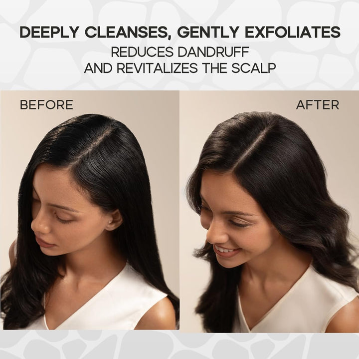HALOVIDA Exfoliante para cuero cabelludo con sal marina, romero y m...