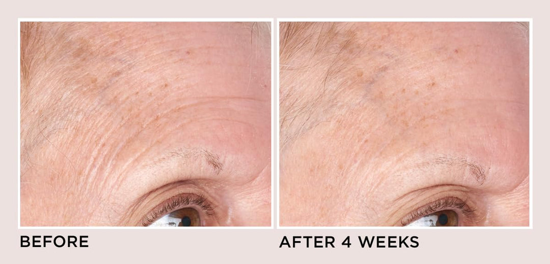 Perricone MD Clásicos de alta potencia: crema hidratante reafirmant...
