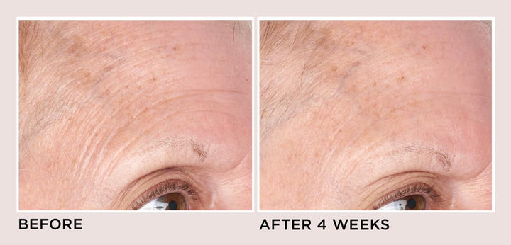 Perricone MD Clásicos de alta potencia: crema hidratante reafirmant...