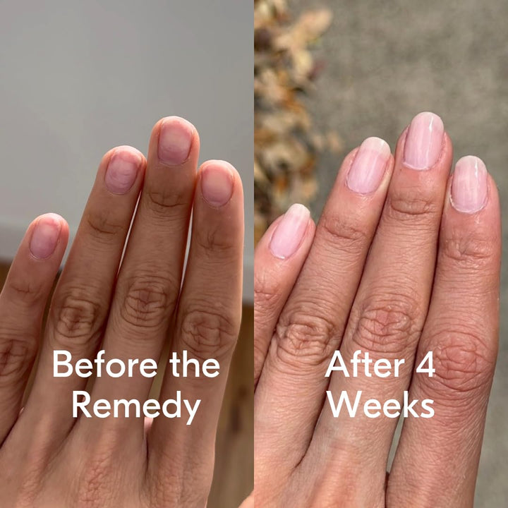Botanist The Remedy | Esmalte fortalecedor para uñas | Repara y end...