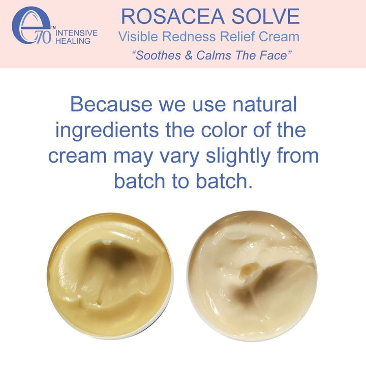 Tratamiento para rosácea para el cuidado de la piel facial en crema...