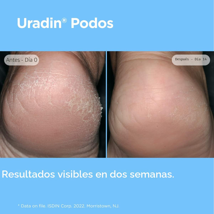 ISDIN Crema para el cuidado de pies, aceite de gel Uradin Podos, re...