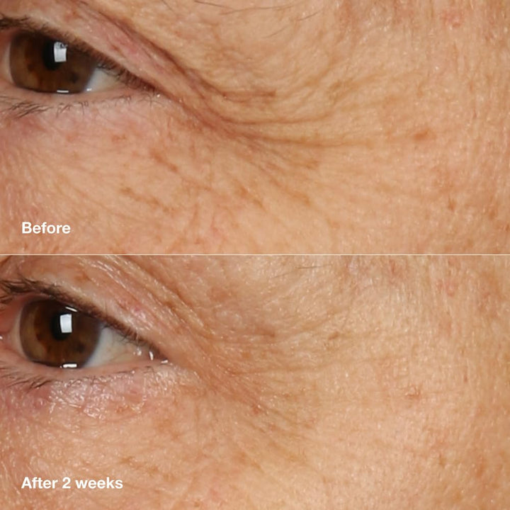 Clinique Smart Clinical Repair - Crema facial antienvejecimiento pa...