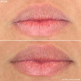 RescueMD Tratamiento restaurador de labios, rejuvenecimiento alimen...