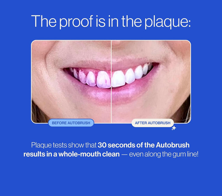 Cepillo de dientes eléctrico sónico Autobrush Pro \u2013 Único cepi...