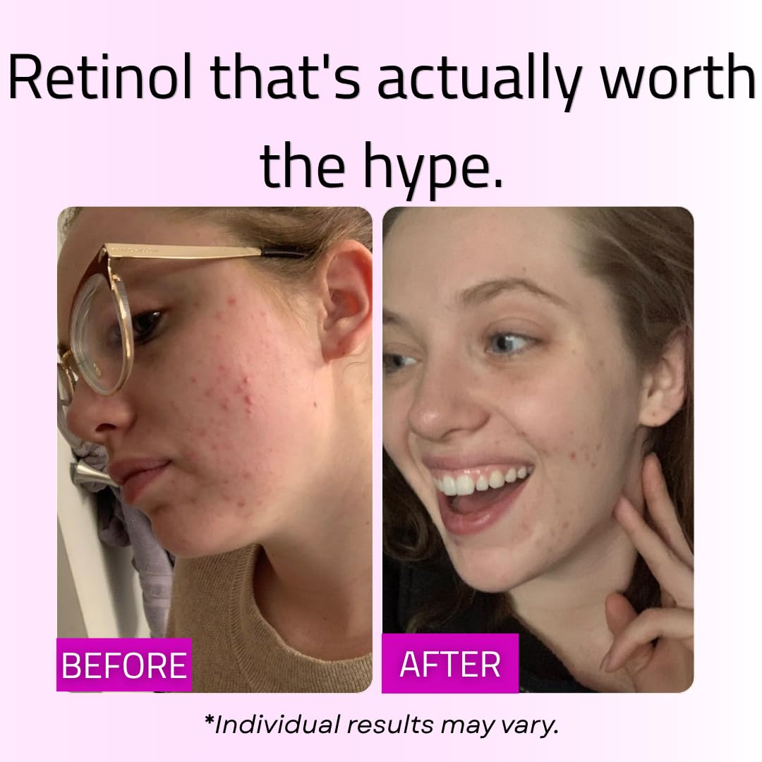 GLEOW Suero de Retinol para el Rostro con Ácido Hialurónico, el Ret...