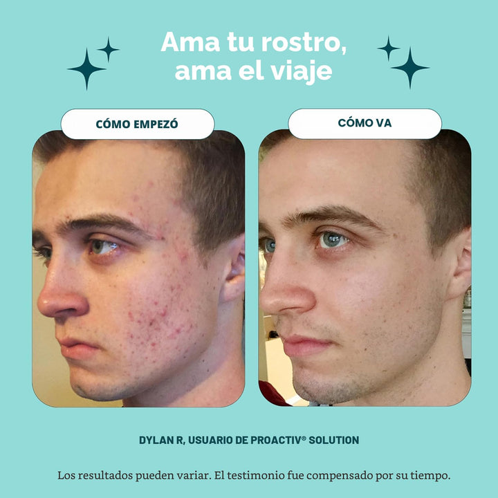 Kit completo de 90 días de cuidado de la piel para acné Proactiv de...