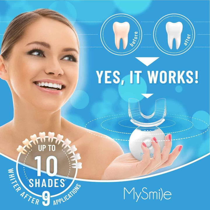 Kit de blanqueamiento de dientes MySmile con luz LED, blanqueador r...
