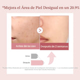 medicube Exosome Shot PDRN - Suero facial de colágeno rosa de 7,500...