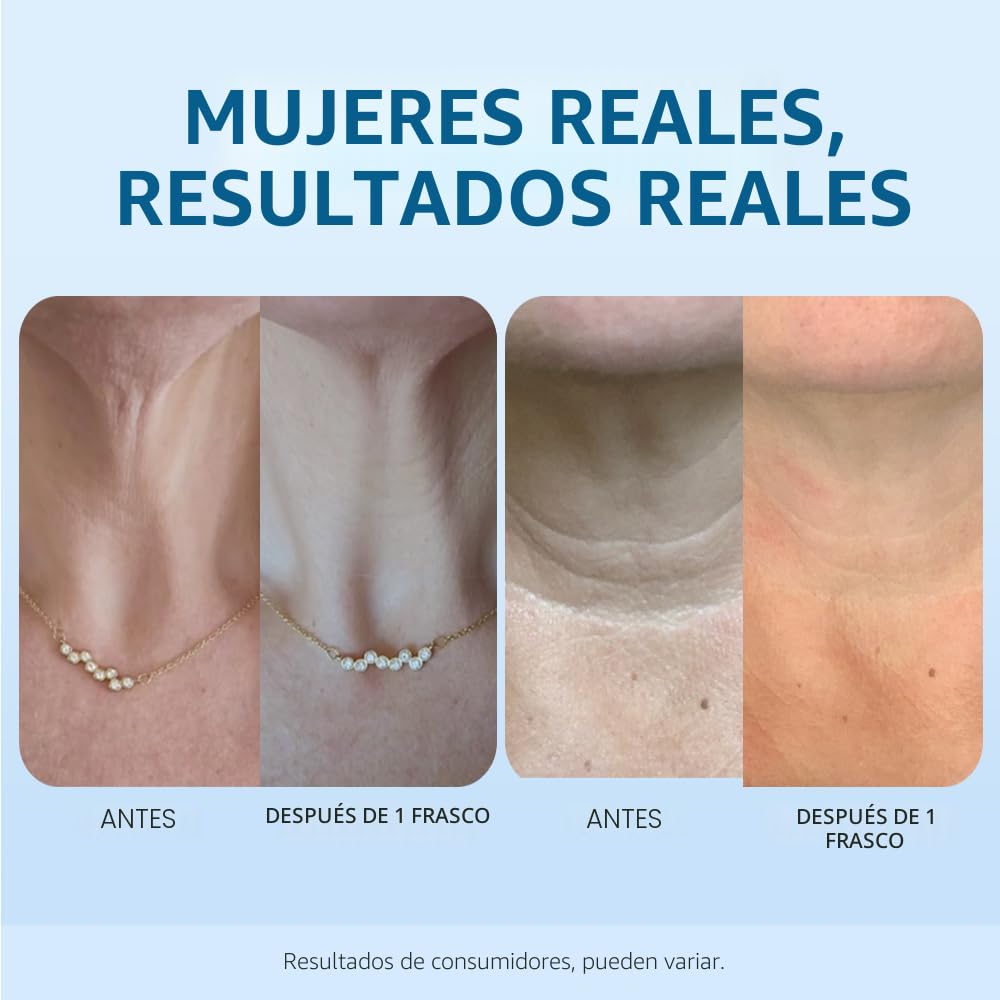 goPure Crema para apretar y levantar el cuello, clínicamente probada
