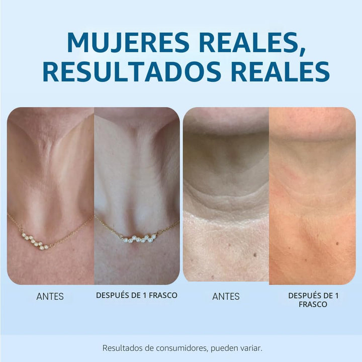 goPure Crema para apretar y levantar el cuello, clínicamente probada