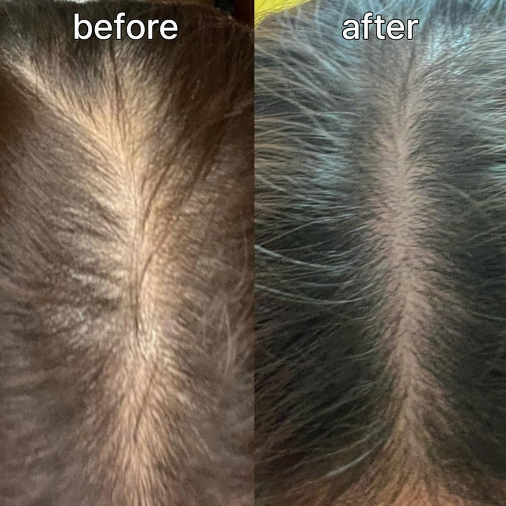 Suero para el Cuero Cabelludo y el Cabello para Cabello Fino de Viv...