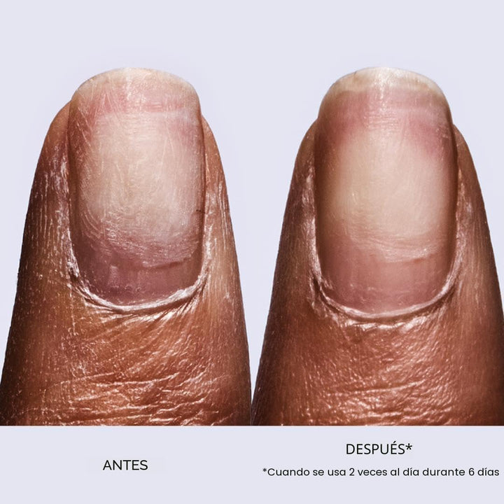 OPI Suero Fortalecedor para Uñas Repair Mode | Tratamiento Fortalec...