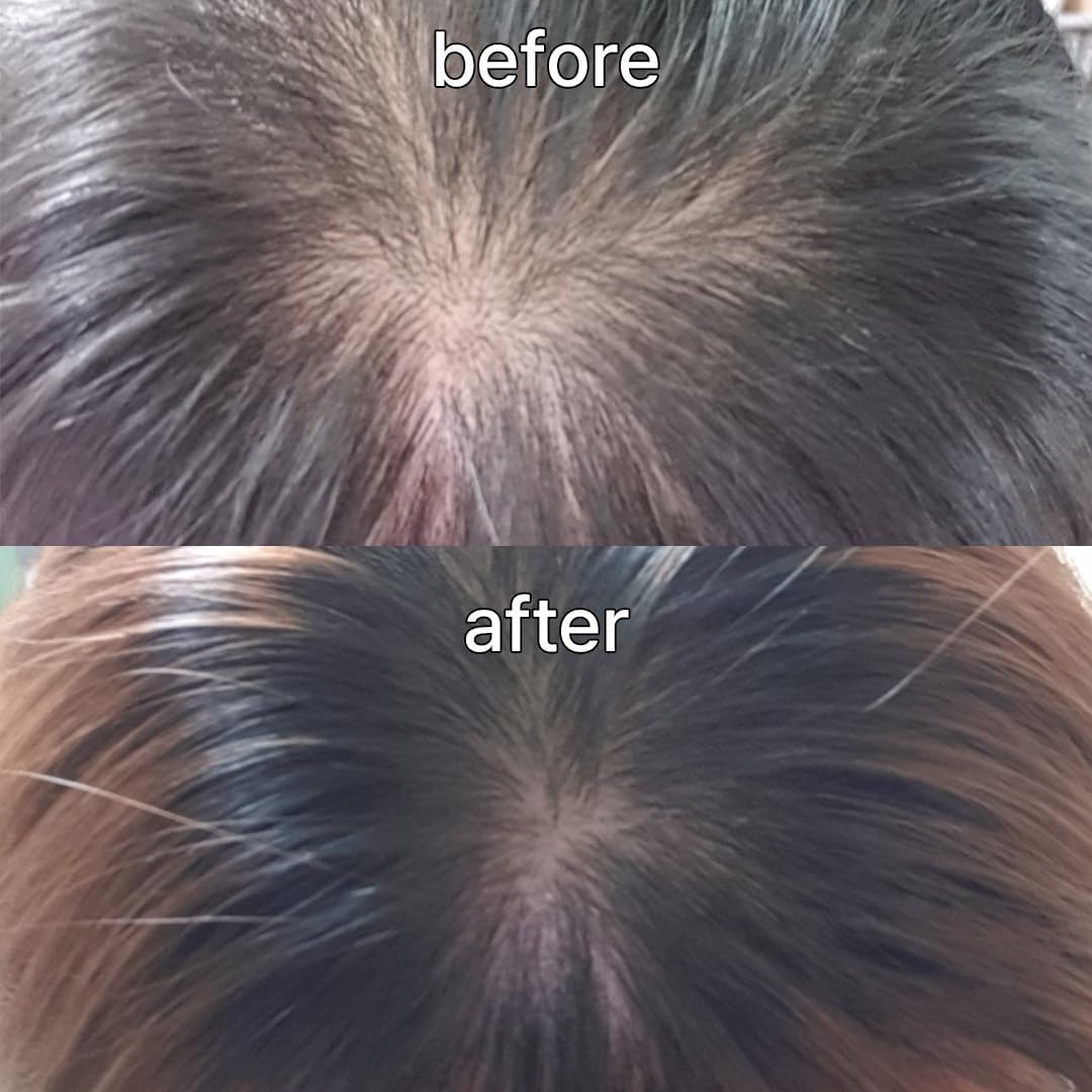 Suero para el Cuero Cabelludo y el Cabello para Cabello Fino de Viv...