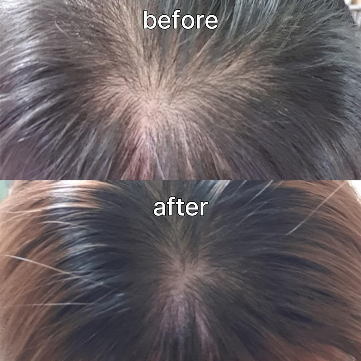Suero para el Cuero Cabelludo y el Cabello para Cabello Fino de Viv...