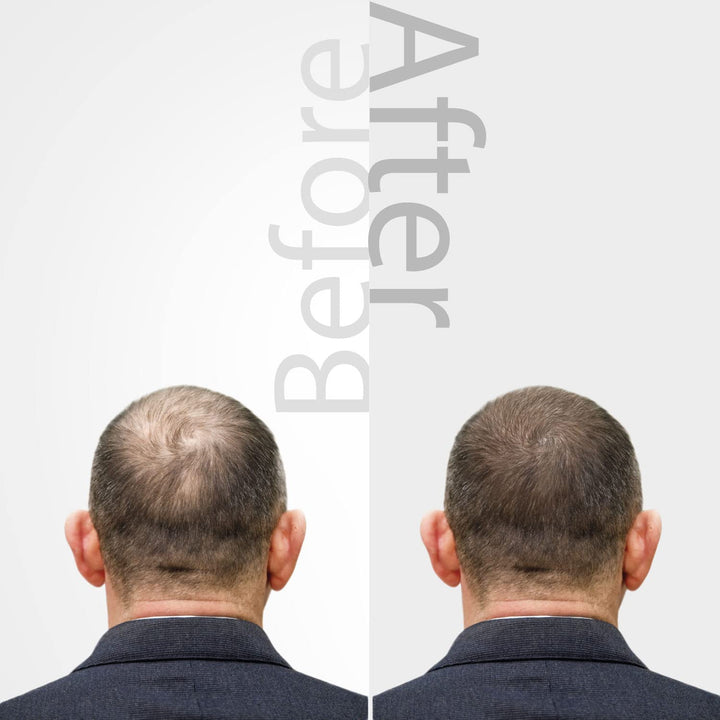 The Mossi London - Suero ozonizado para el cabello y el cuero cabel...