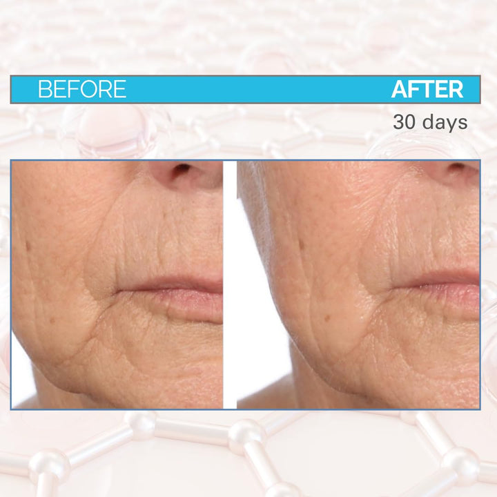 Serious Skincare Relleno profundo de arrugas para cara y cuello, Dr...