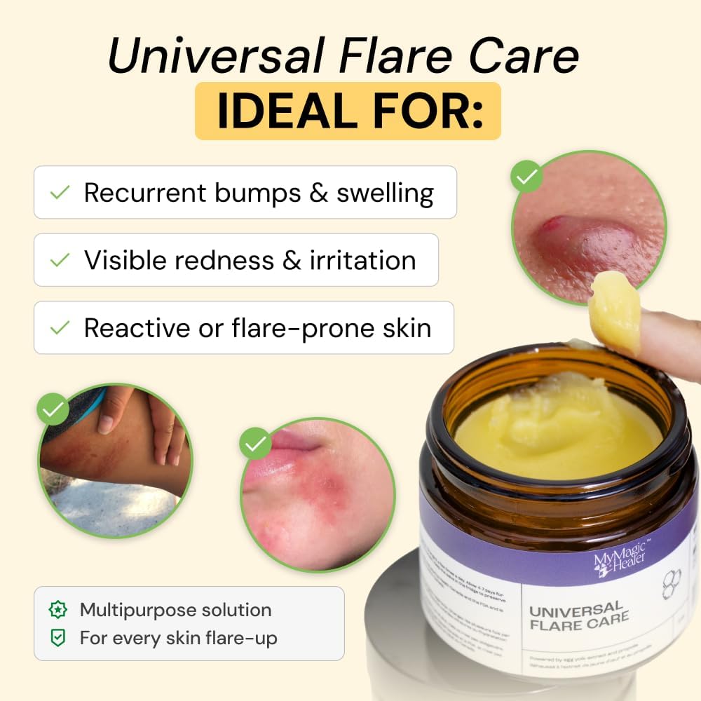 MyMagicHealer Universal Flare Care | Pomada extractora para HS, for...