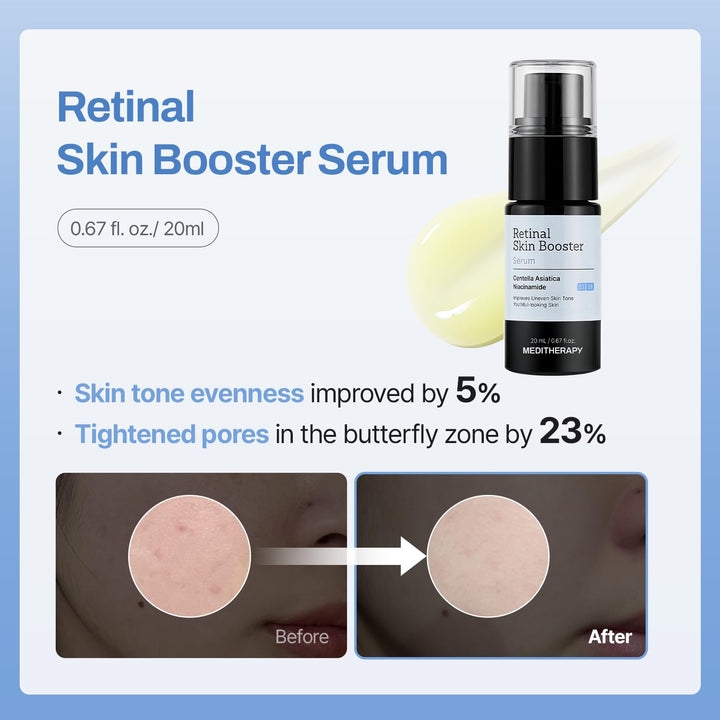 MEDITHERAPY Kit Gentle Boost - Set coreano para el cuidado de la pi...