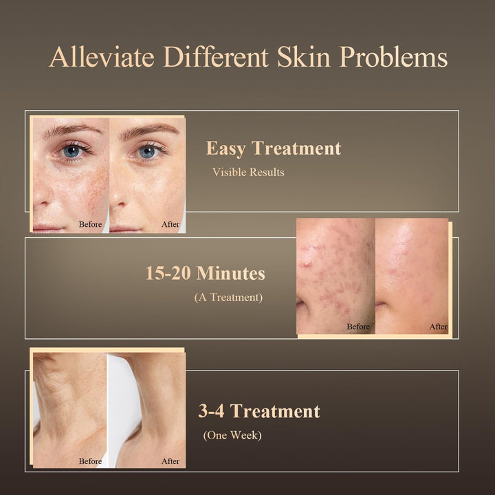 MEGELIN Máscara facial y cuello de terapia de luz roja, máscara fac...
