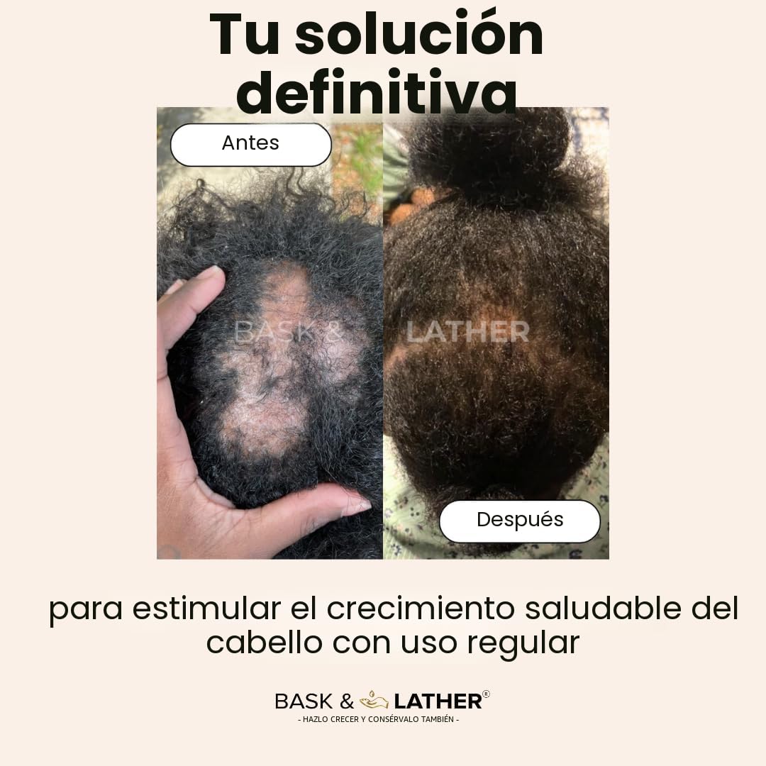 Aceite para el crecimiento del cabello y estimulador del cuero cabe...