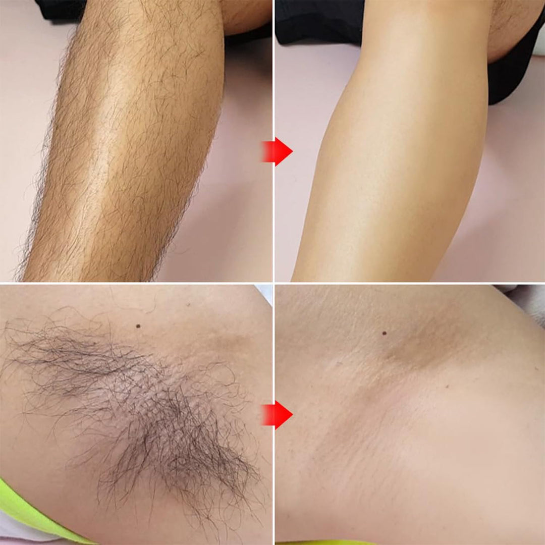 Gel depilatorio sin dolor para el área del bikini, tratamiento para...
