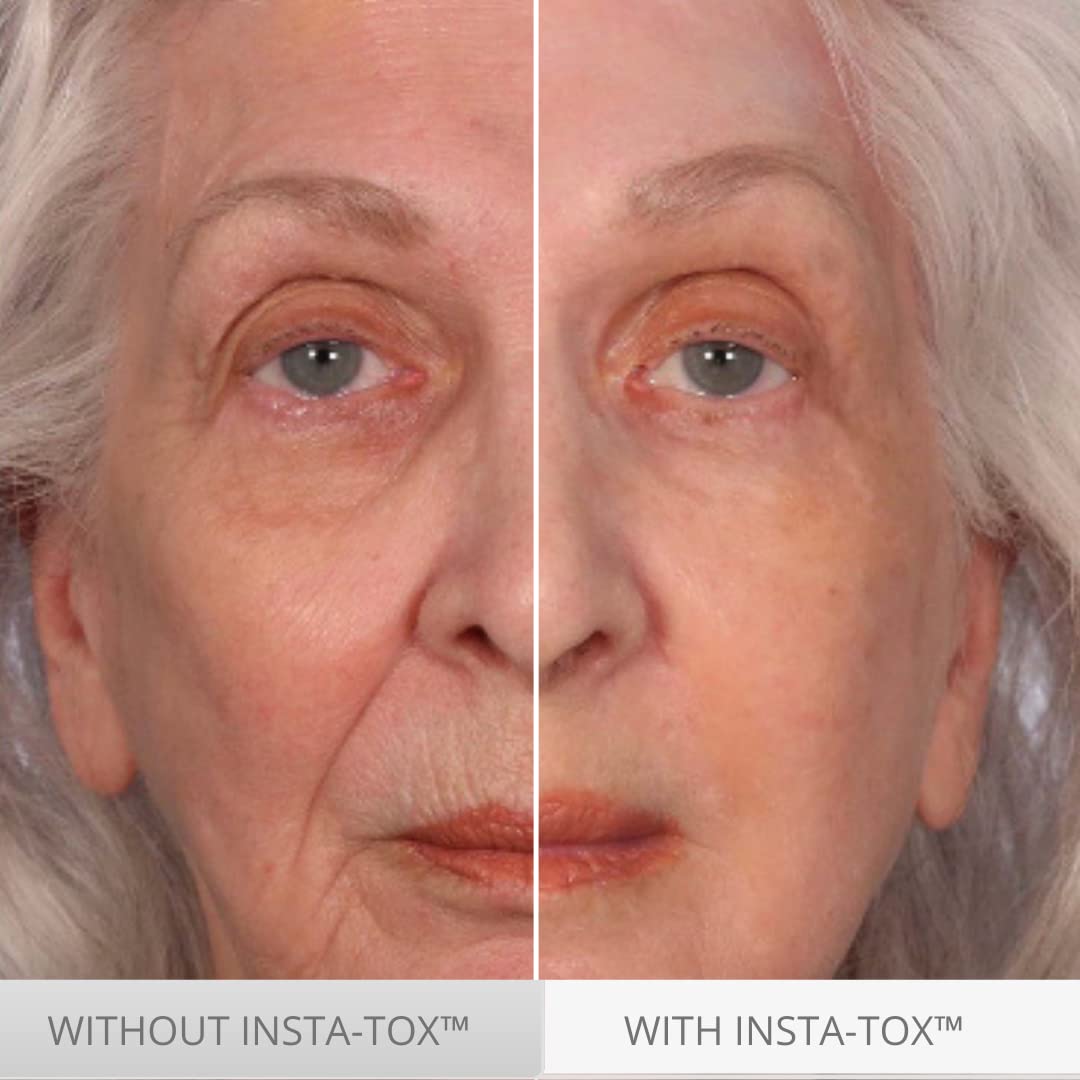 Serious Skincare INSTA-TOX - Suero instantáneo para la piel, suaviz...