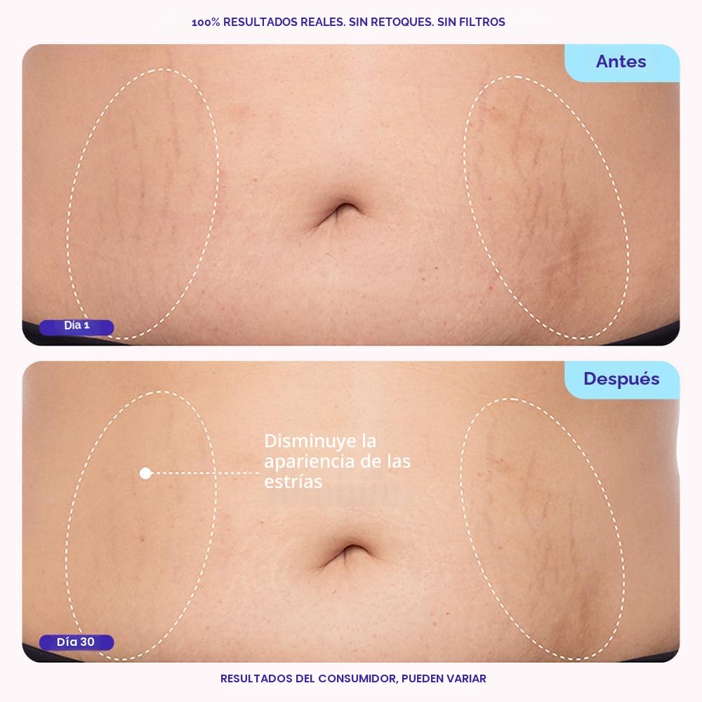 goPure Crema reafirmante para el vientre - Hidratante reafirmante c...