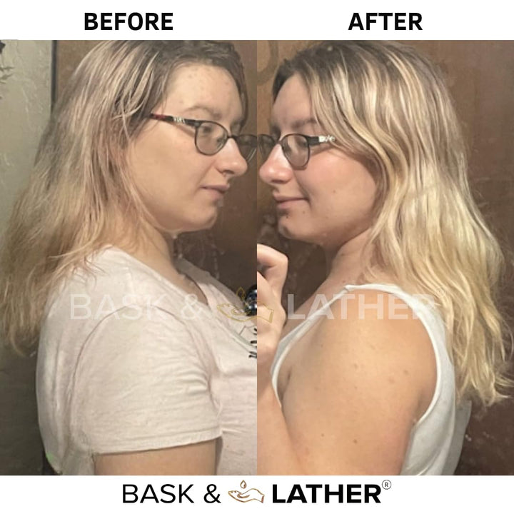 Aceite para el crecimiento del cabello y estimulador del cuero cabe...