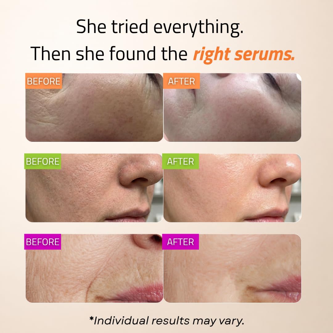 GLEOW Suero de Retinol para el Rostro, Vitamina C con Suero Facial...