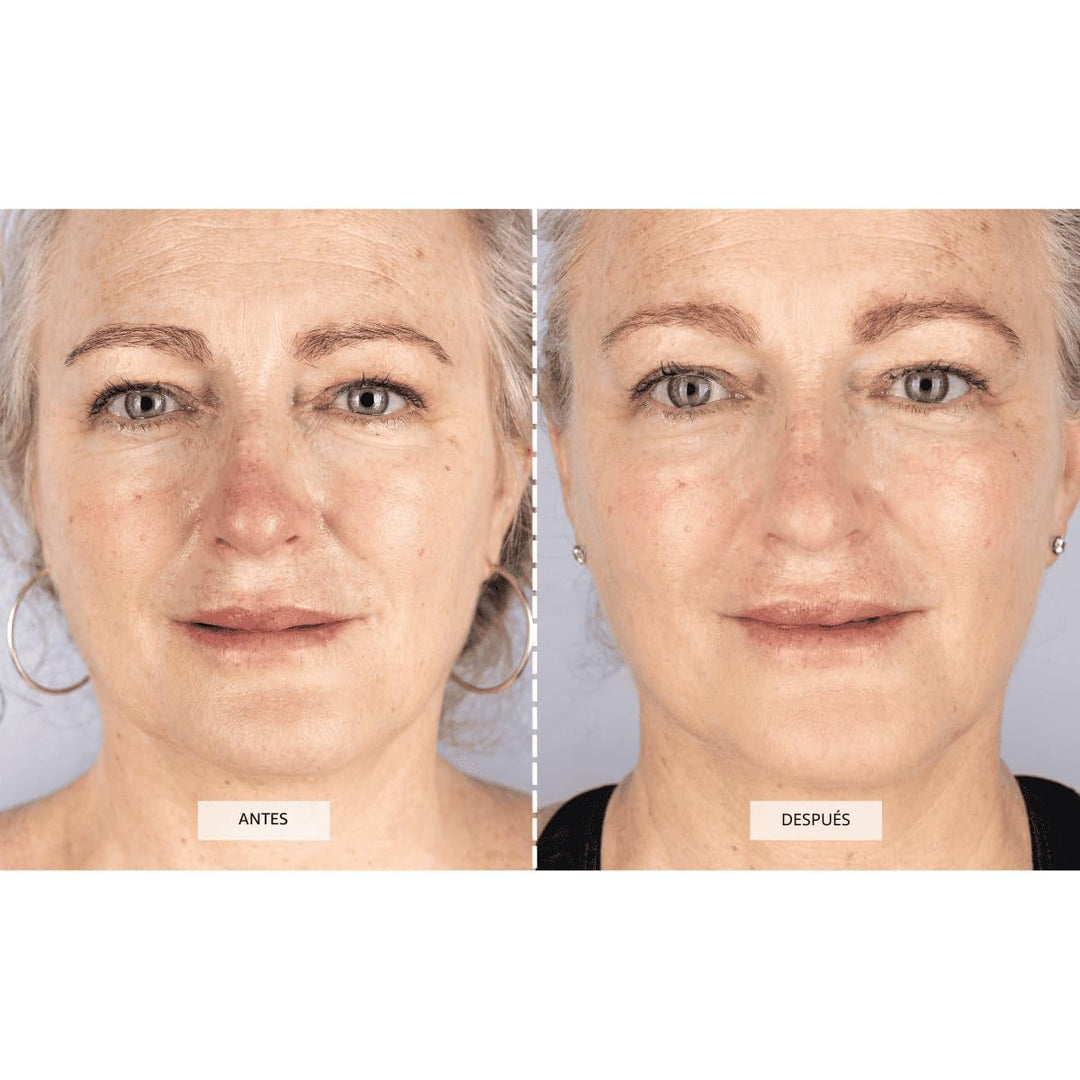 Máscara Facial de Terapia de Luz LED CurrentBody Skin | Dispositivo...